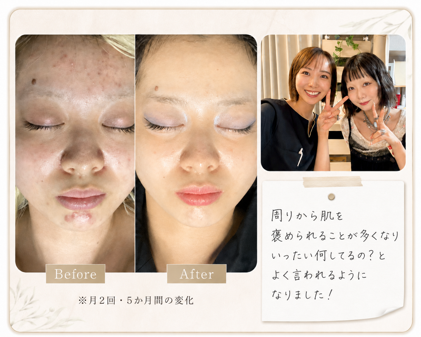 お客様①のBefore/After・スタッフとの2ショット・感想コメントをまとめた1枚