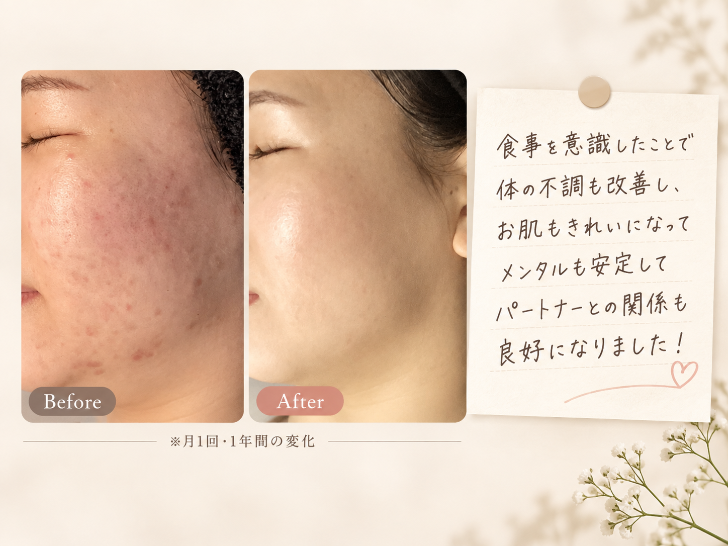 お客様②のBefore/After・スタッフとの2ショット・感想コメントをまとめた1枚
