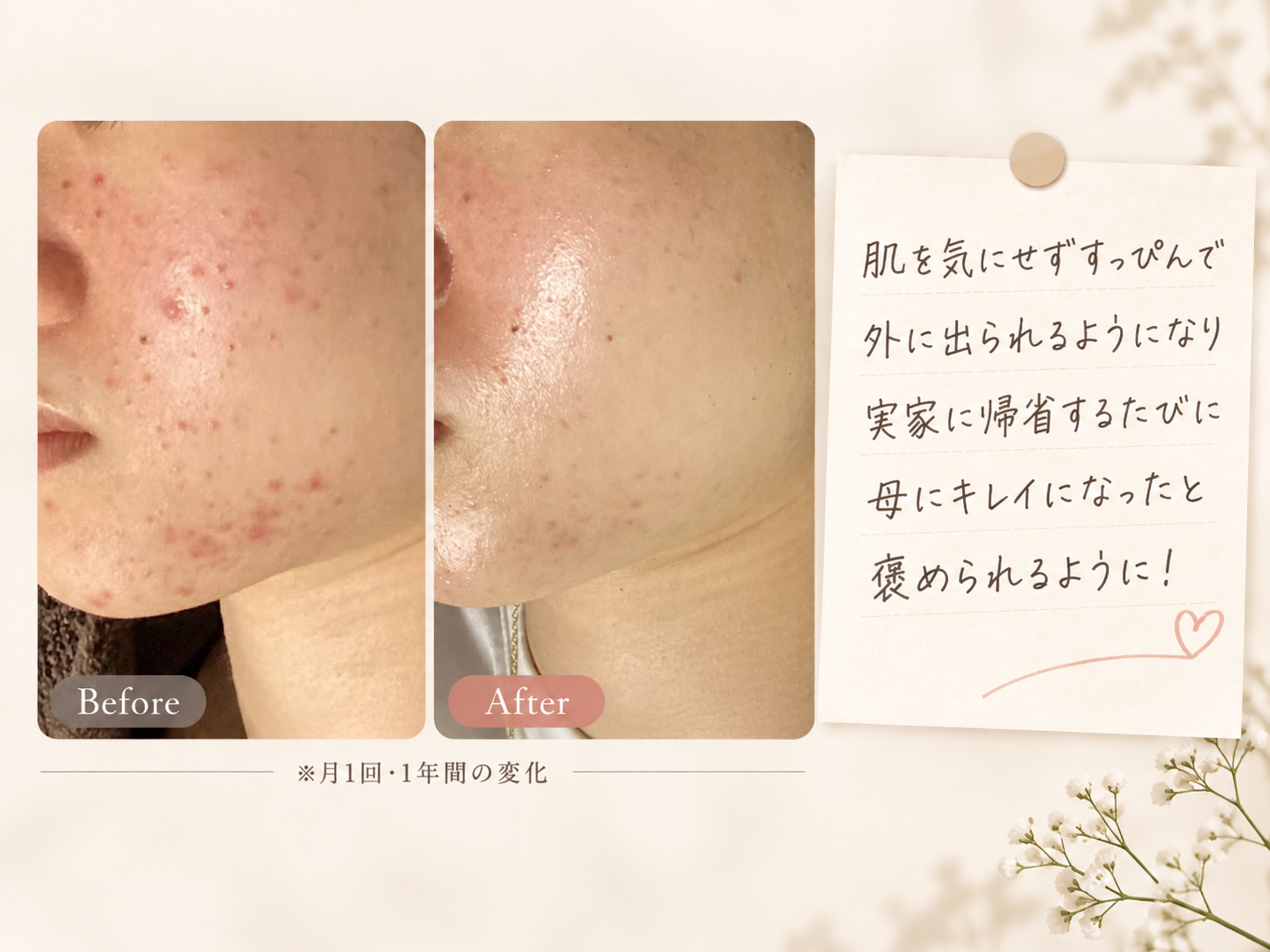 お客様③のBefore/After・スタッフとの2ショット・感想コメントをまとめた1枚